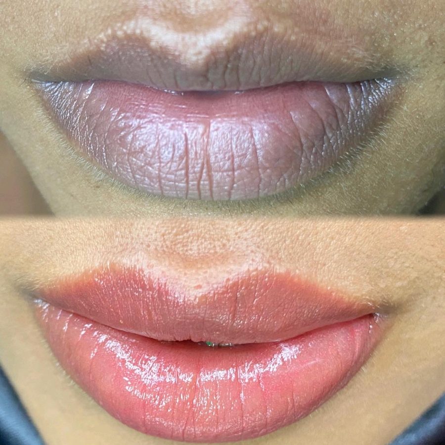 Resultado de micropigmentação labial 01