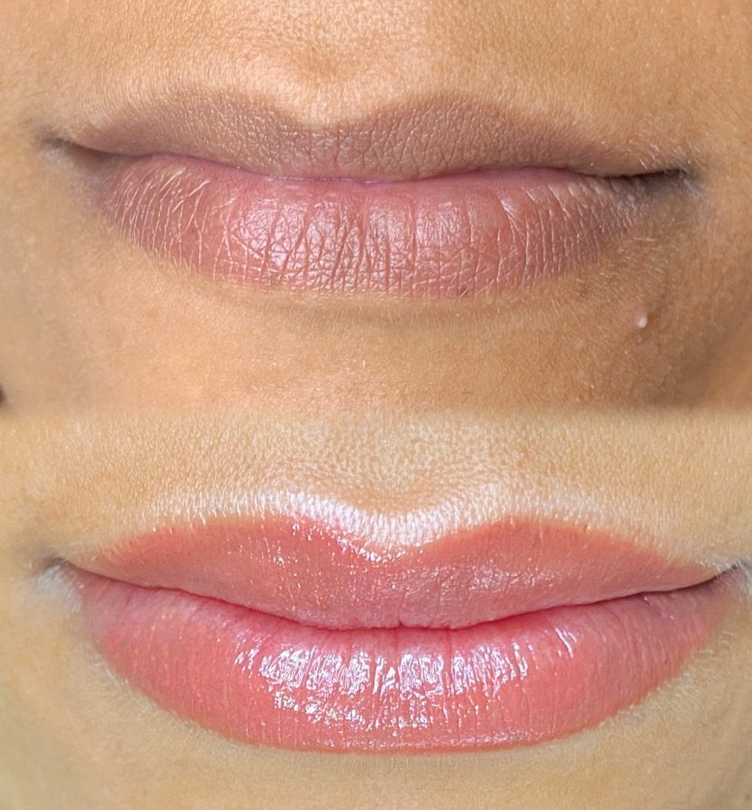 Resultado de micropigmentação labial 04