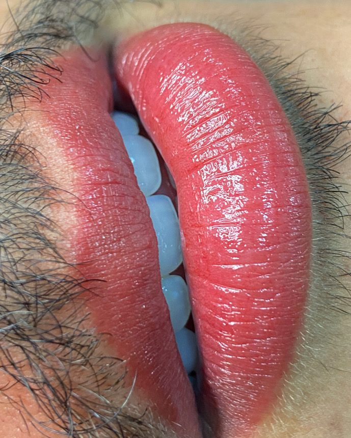 Resultado de micropigmentação labial 06
