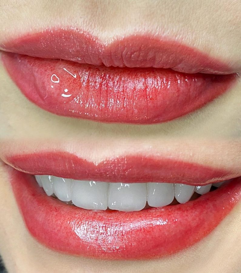 Resultado de micropigmentação labial 08