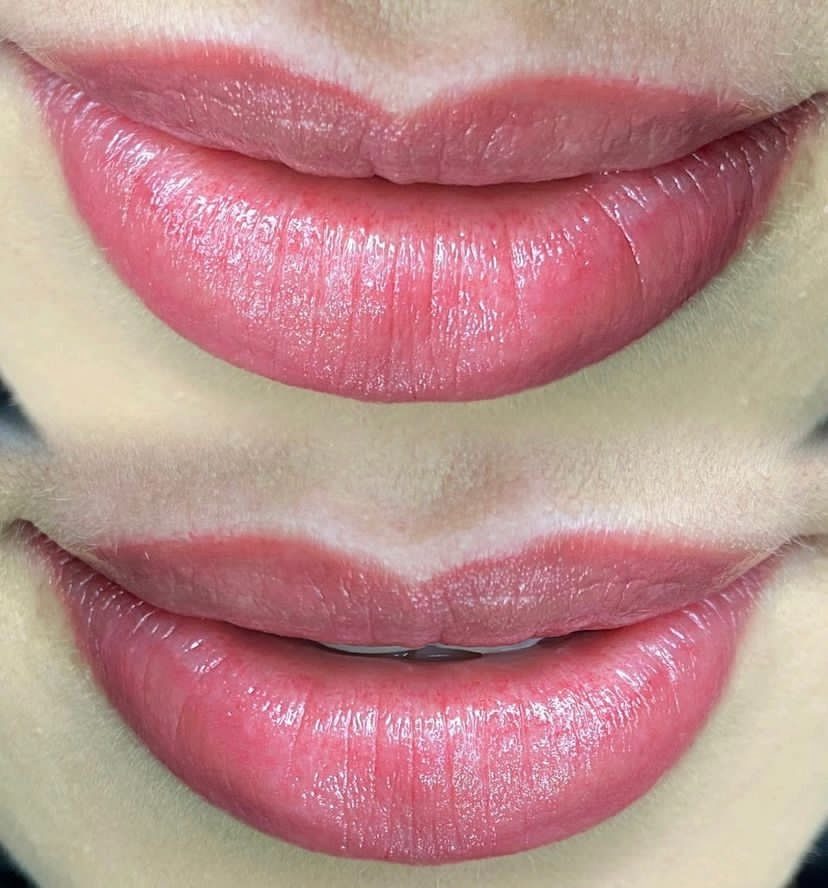 Resultado de micropigmentação labial 09