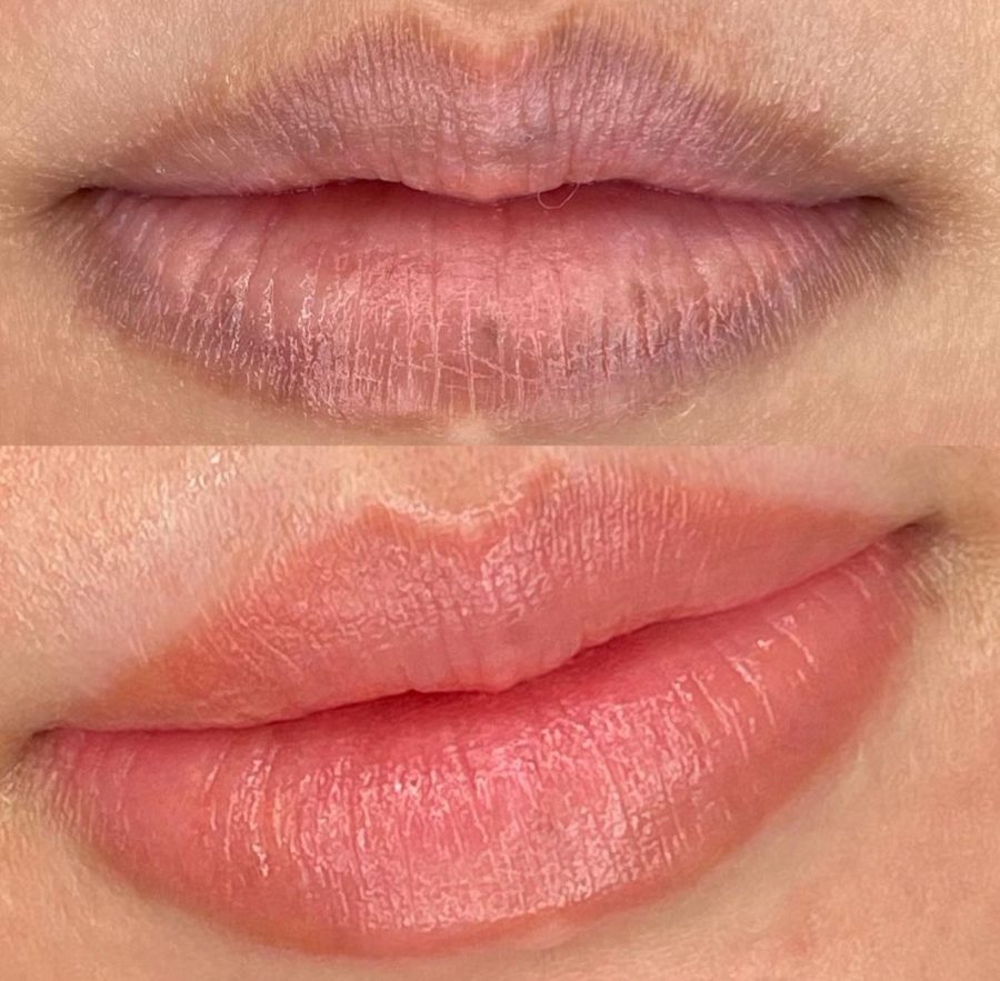 Resultado de micropigmentação labial 10