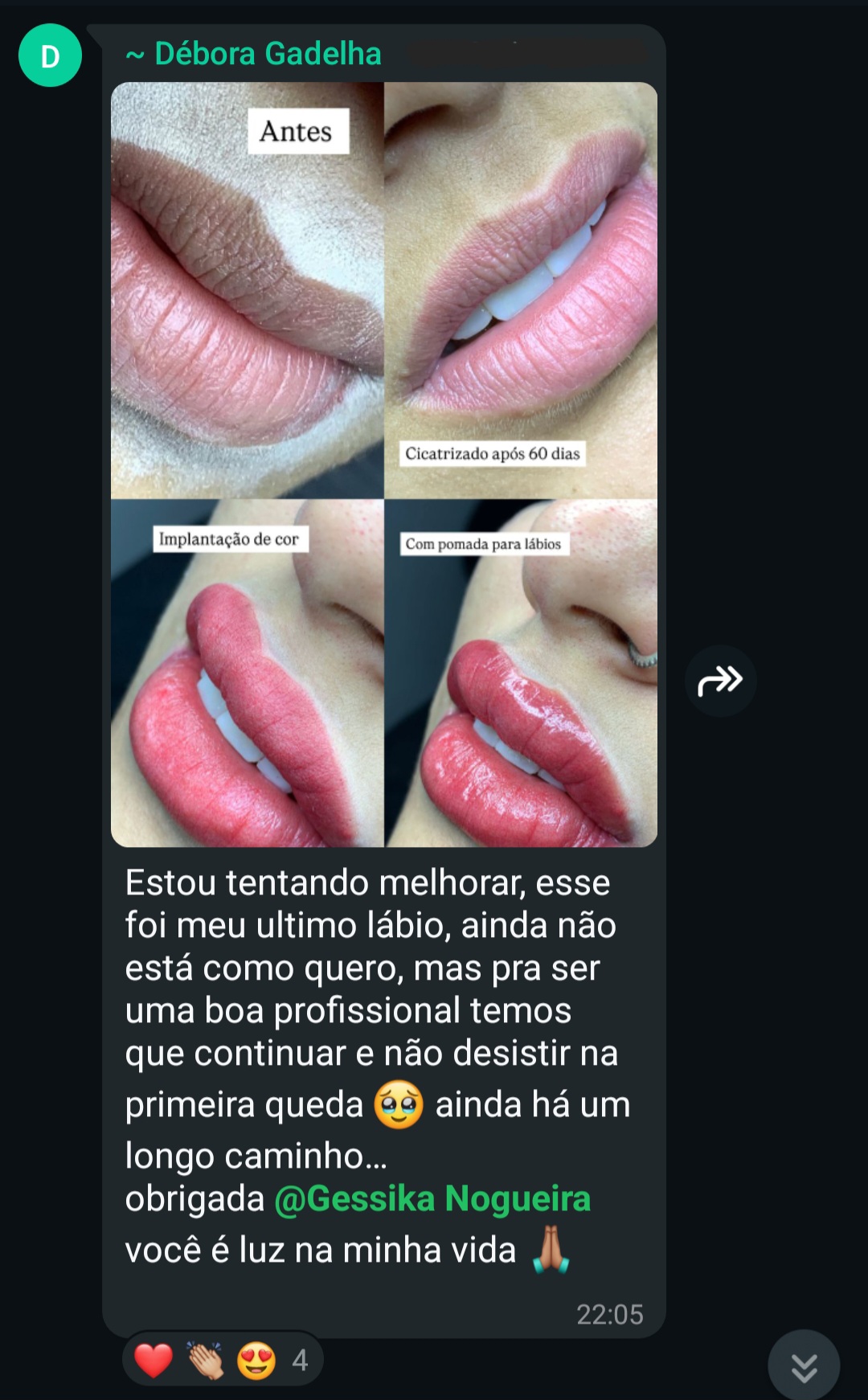 Depoimento de Débora — antes e depois com cor cicatrizada após 60 dias